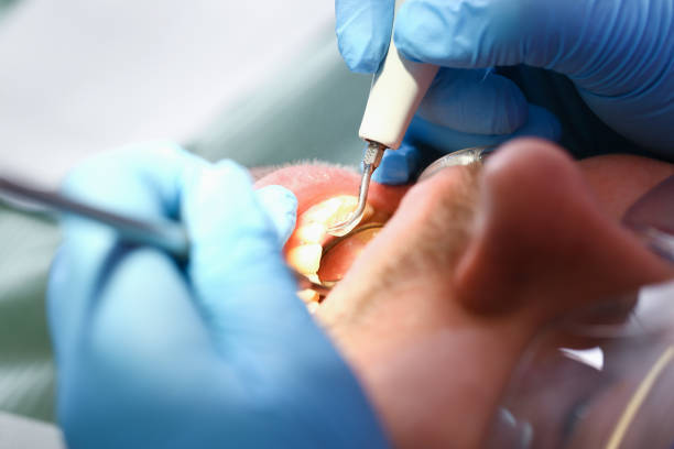 Best Tooth Infection Emergency Dentist  in Clemson University, SC
